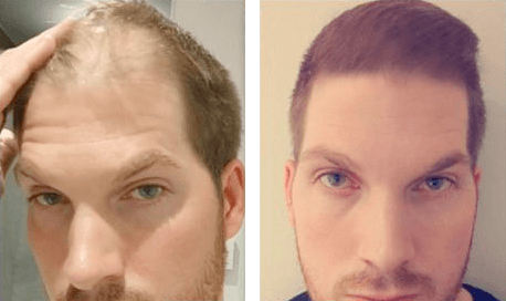 Kasper fra Jylland 4200 ved front omradet